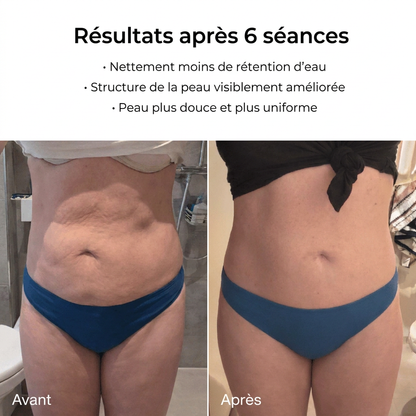 CellLuvia– une peau lisse en 14 jours